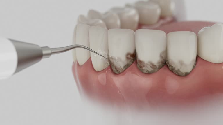 Reliable Root Canal Treatment contractor in Johnston County County, NC by Dentist Open Now